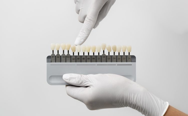  Enhance Your Smile with a Full Ceramic Crown in Abu Dhabi at Ittihad Medical Centre