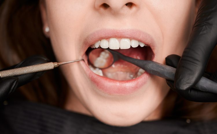  Tooth Removal in Abu Dhabi – Your Guide to Comfortable, Professional Dental Care